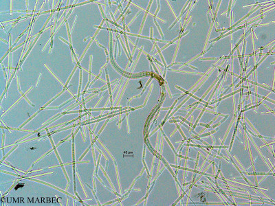 phyto/Mayotte/dziani/DZIANI 2007-2016/Nematoda (copy)_thumb.jpg